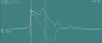 PDA results.png